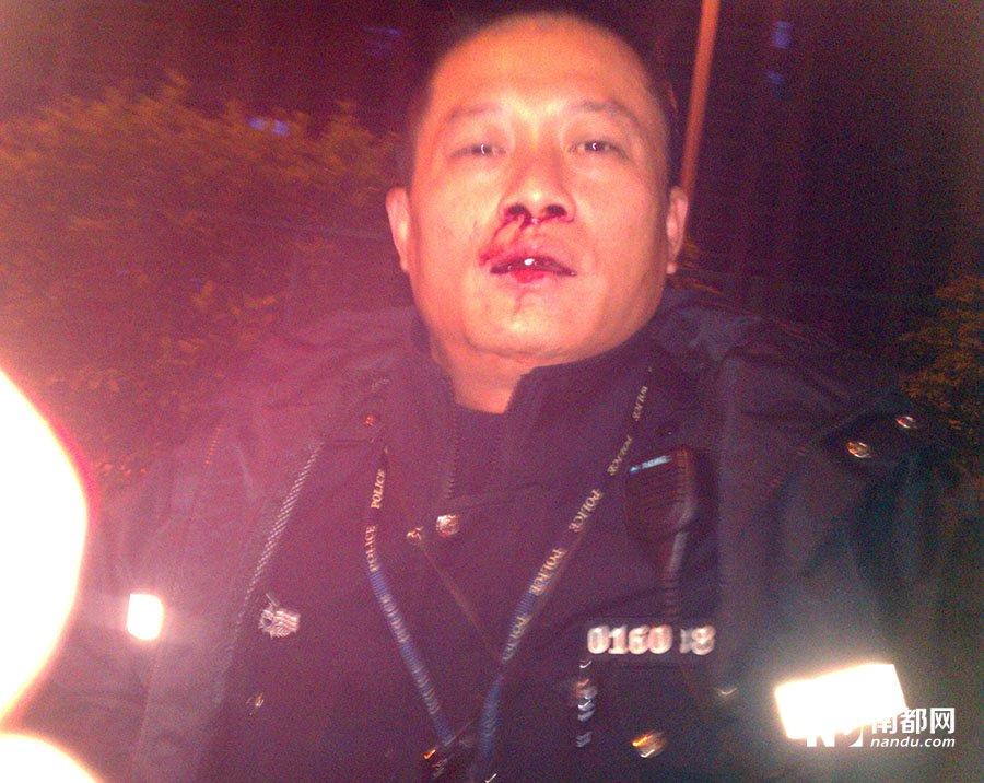 男子疑被交警咬掉手指